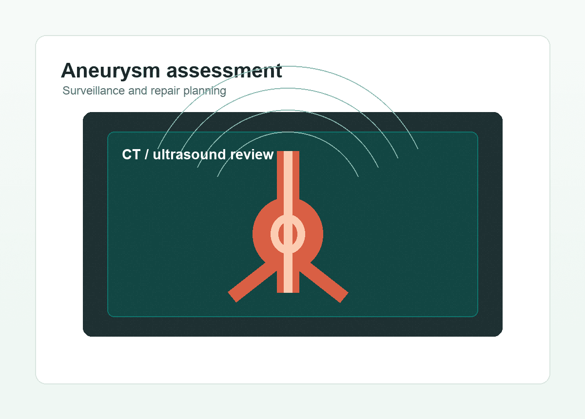 Aneurysm assessment imaging illustration