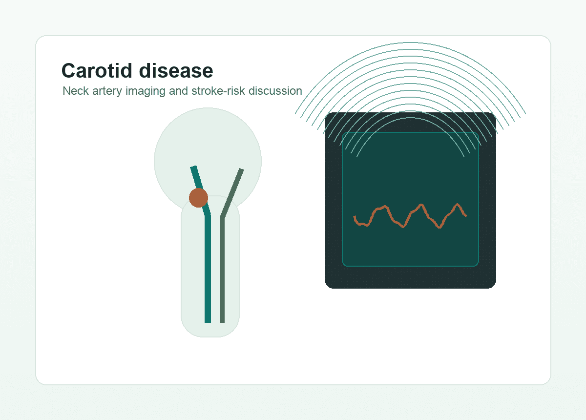 Carotid artery disease illustration