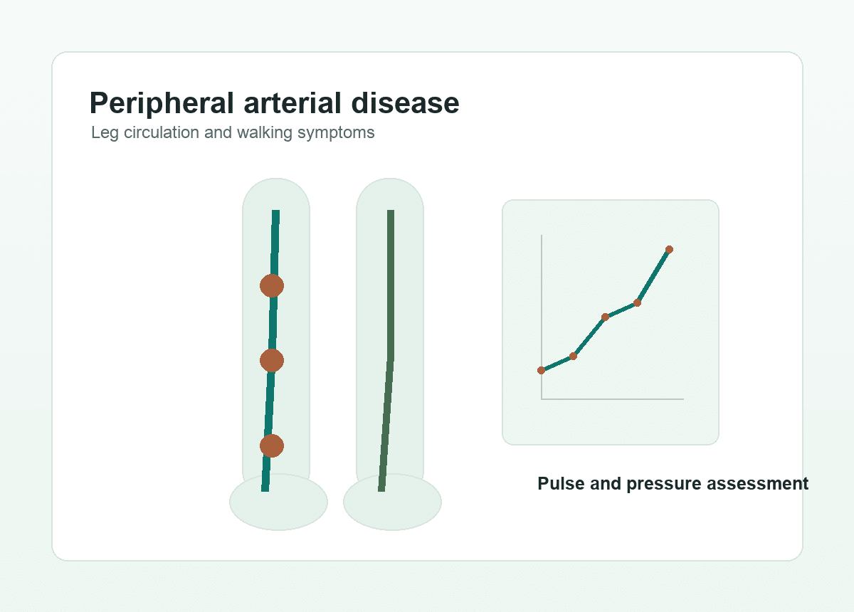 Peripheral arterial disease leg circulation illustration